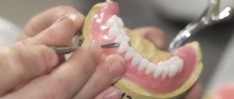 Repair of dentures