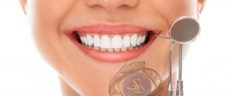 Реставрация передних зубов: прямая и непрямая