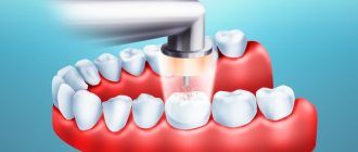 The effectiveness of caries treatment with ozone