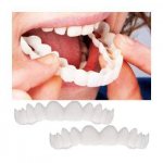 Removable veneers Perfect Smile, Snap-On Smile