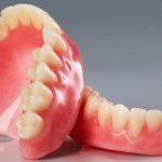 Съемные зубные протезы: какие лучше