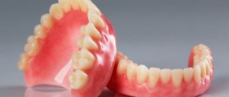 Removable dentures: which ones are better?