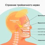 Symptoms of trigeminal neuralgia in pictures
