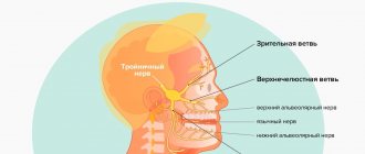 Symptoms of trigeminal neuralgia in pictures