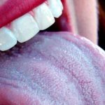 Blue coating on the tongue