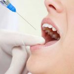 Dentist makes an anesthetic injection