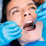 Стоматолог пародонтолог: что делает и что лечит