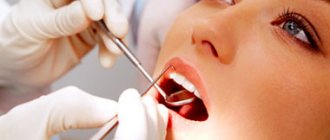Стоматологические индексы гигиены - Индексы гигиены в стоматологии
