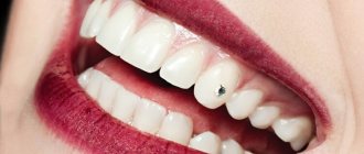 rhinestones on a person&#39;s teeth