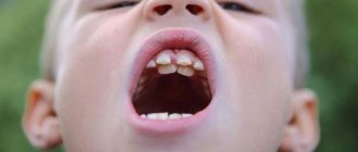 У детей акульи зубы что делать опасно или нет