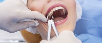 Removing the root of a rotten, decayed tooth