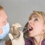 Removal of a tooth