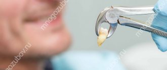 Удаление зубов с выступившим герпесом