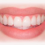 Teeth lengthening