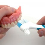 Care and cleaning of removable dentures (acrylic, Acri-Free, nylon, clasp)