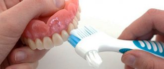 Уход и чистка съемного зубного протеза (акриловые, Акри-Фри, нейлоновые, бюгельные)
