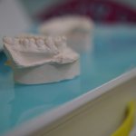 установки зубного импланта