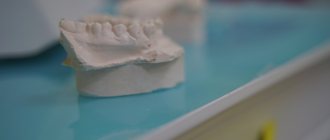 dental implant installation