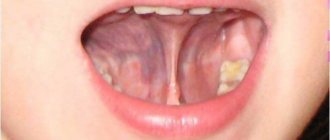 Tongue frenulum