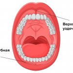 Frenules of the upper and lower lips in pictures