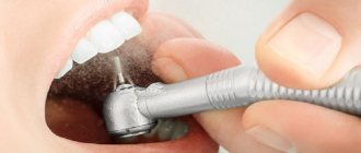 In what cases is a temporary filling placed on a tooth?