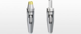 types of abutments