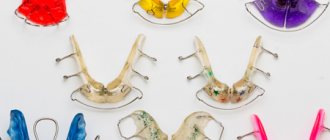 Types of functional orthodontic devices