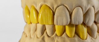 wax modeling of teeth