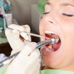 Is tooth trephination always necessary before endodontic treatment and what is it?