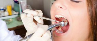 Is tooth trephination always necessary before endodontic treatment and what is it?