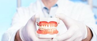 Выбор протезирования зубов