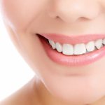 Teeth straightening without braces in adults