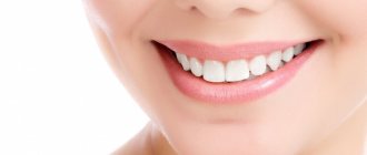 Выравнивание зубов без брекетов у взрослых