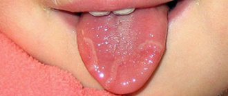 baby&#39;s tongue