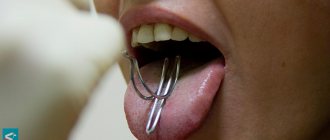 probe tongue massage