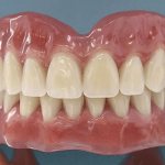 dentures with suction cups in the absence of teeth